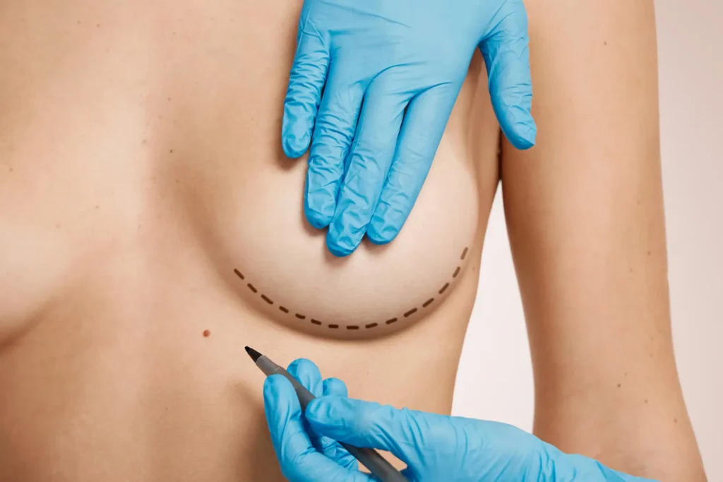 Breast Augmentation & Reduction