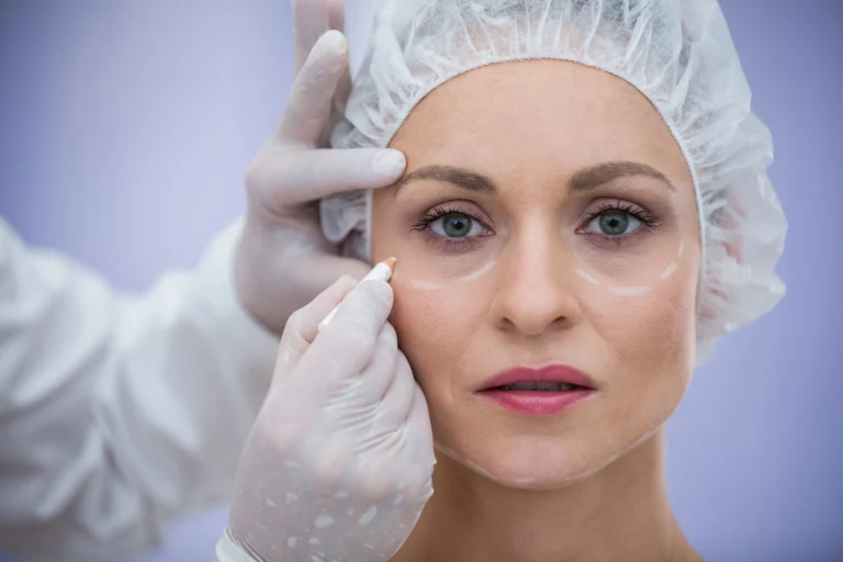 doctor marking female patients face cosmetic treatment
