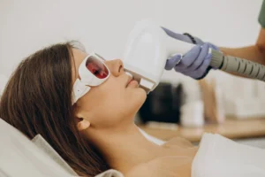 laser epilation hair removal therapy