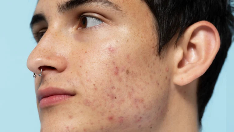 side view man with skin problems