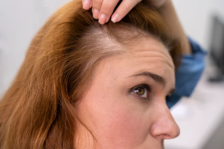 woman getting hair loss treatment clinic 1 1
