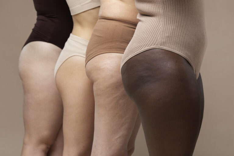 different women standing together