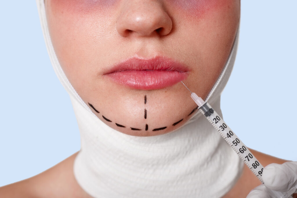 half face beautiful young caucasian woman with perforation lines chin before plastic surgery operation