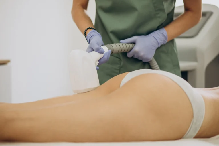 laser epilation hair removal therapy 2