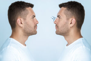 man getting ready nose job surgery
