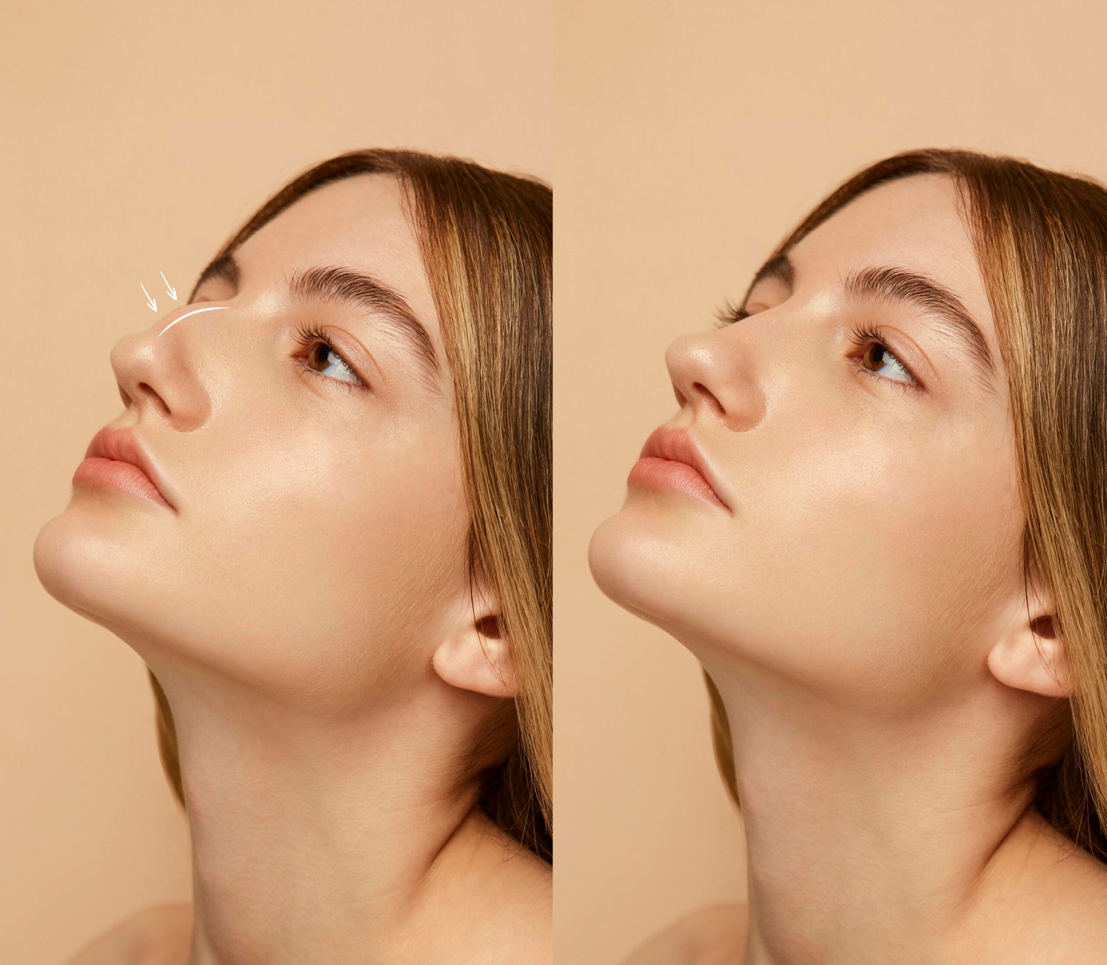 Facelift vs Thread Lift – What Is Better for Long Lasting Results | Eternity Hospital