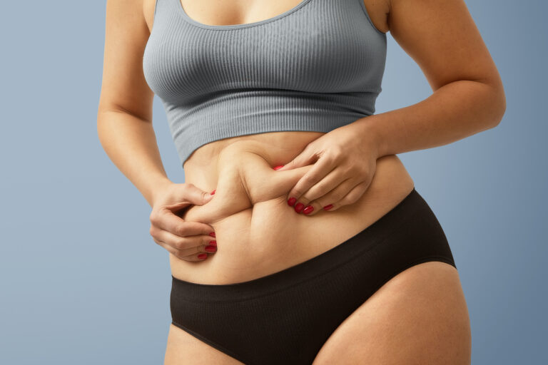 woman body fat belly obese woman hands holding excessive tummy fat change diet lifestyle concept shape up healthy stomach muscle studio anonymous shot photo body parts