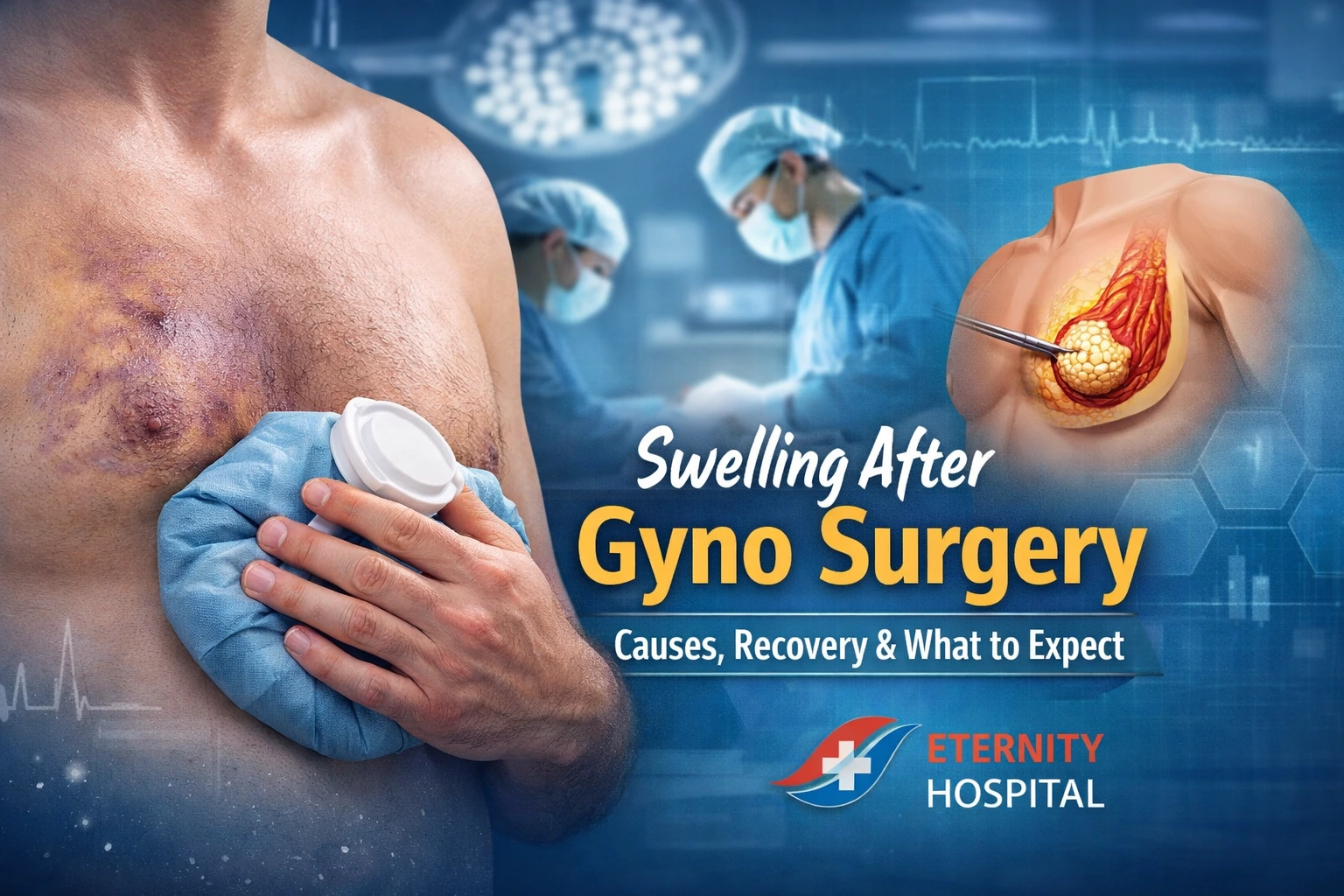 Swelling After Gyno Surgery: Causes, Recovery, and What to Expect