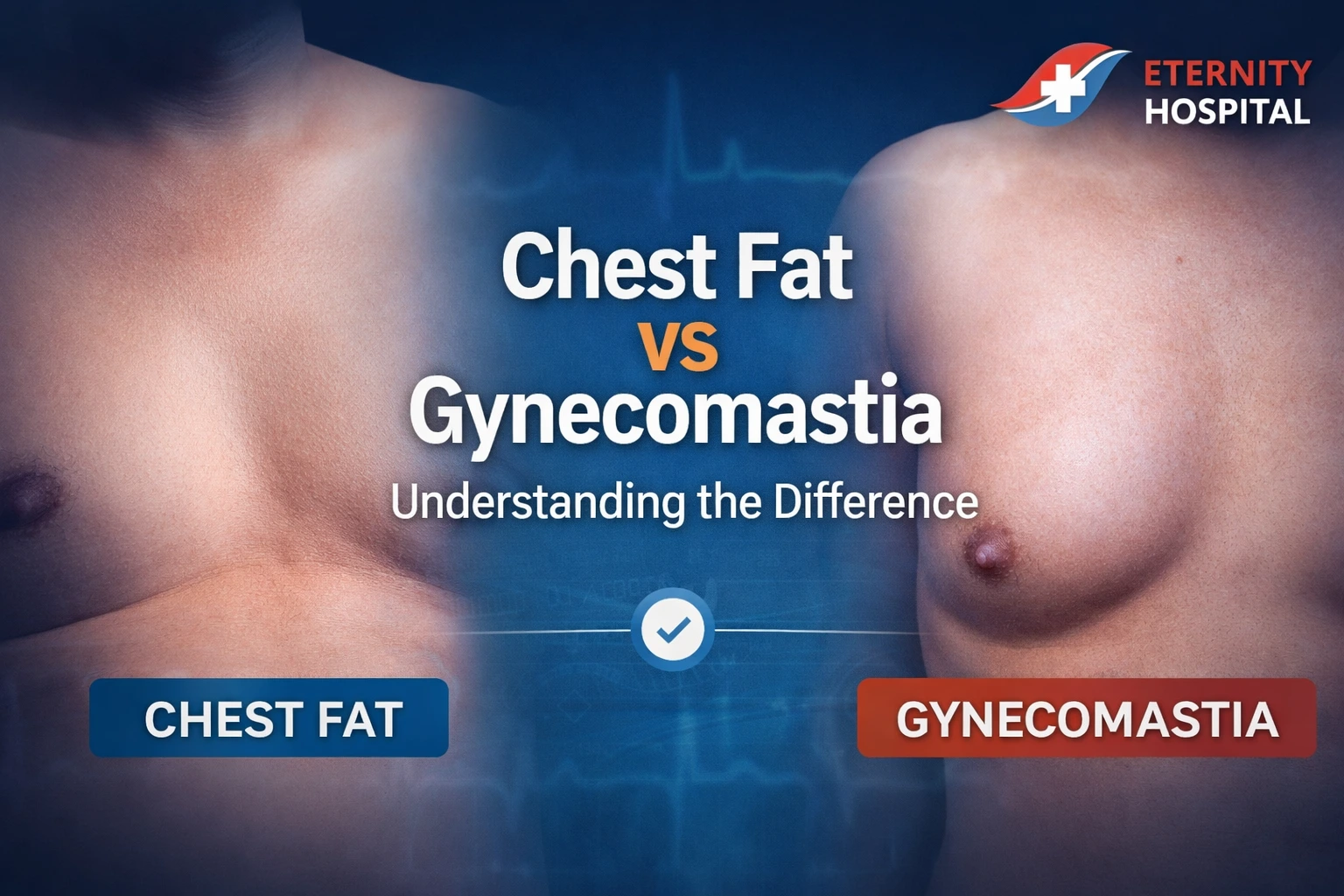 Chest Fat vs Gynecomastia: Understanding the Real Difference