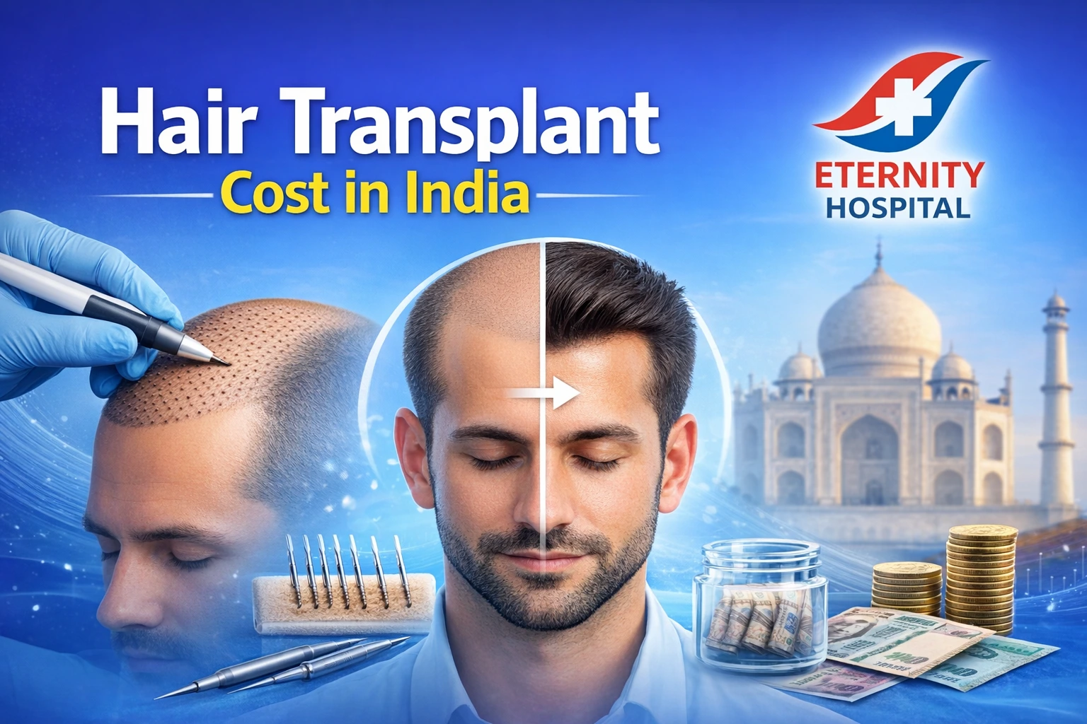 Hair Transplant Cost in India  Complete Guide