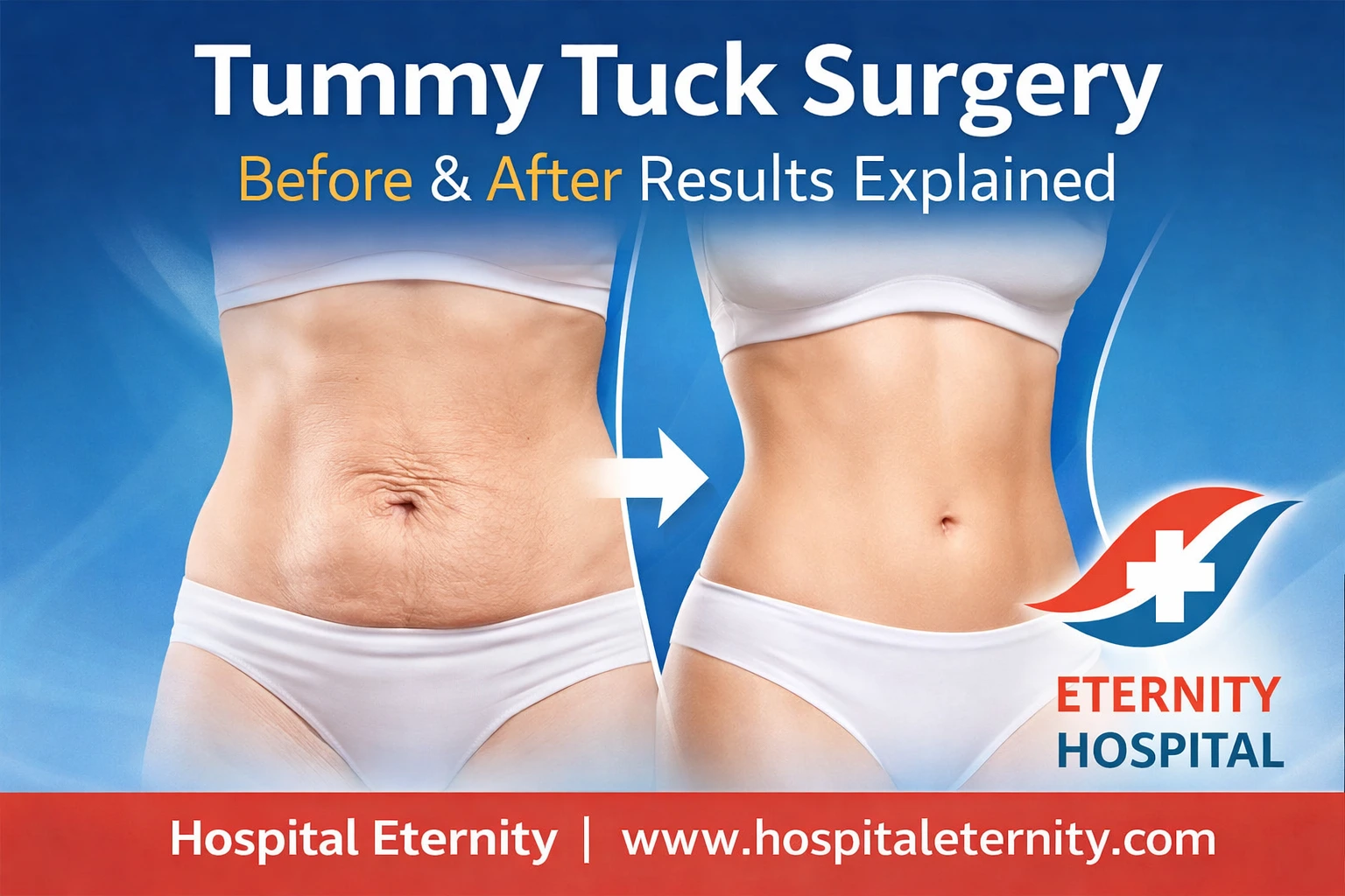 Tummy Tuck Surgery: Before & After Results Explained