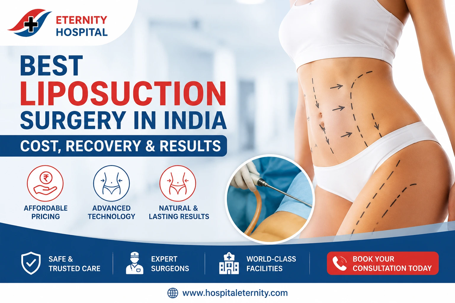 Best Liposuction Surgery in India: Cost, Recovery & Results