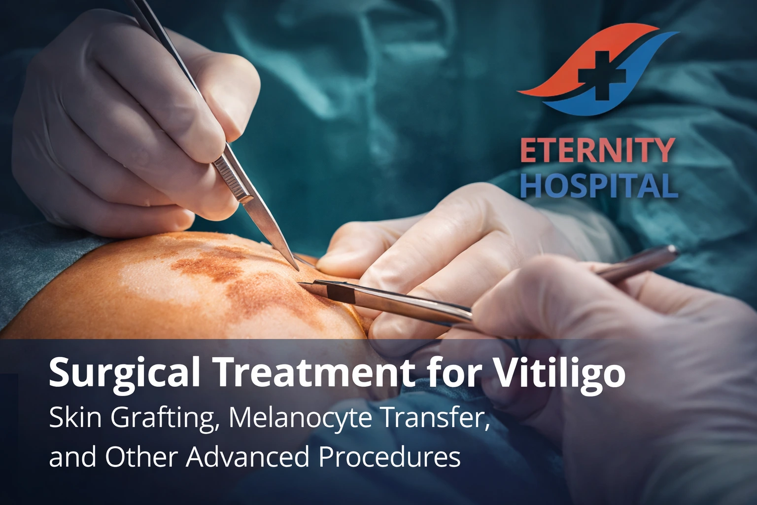 Surgical Treatment for Vitiligo: Skin Grafting, Melanocyte Transfer, and Other Advanced Procedures