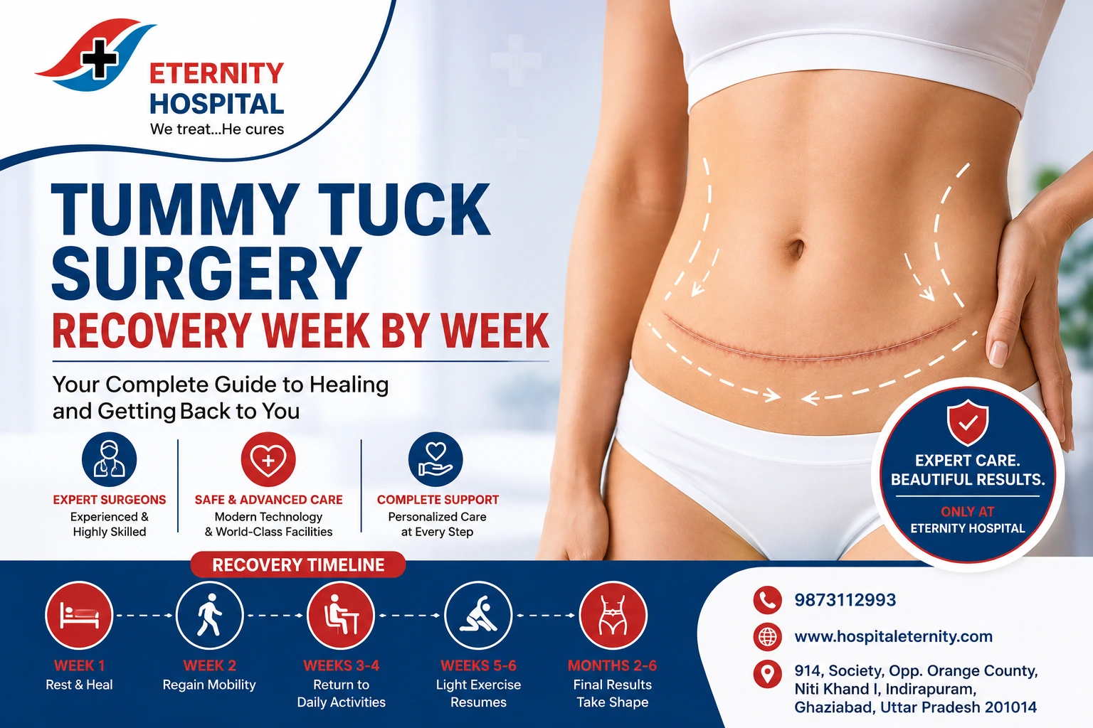 Tummy Tuck Surgery Recovery Week by Week: What to Expect After Abdominoplasty